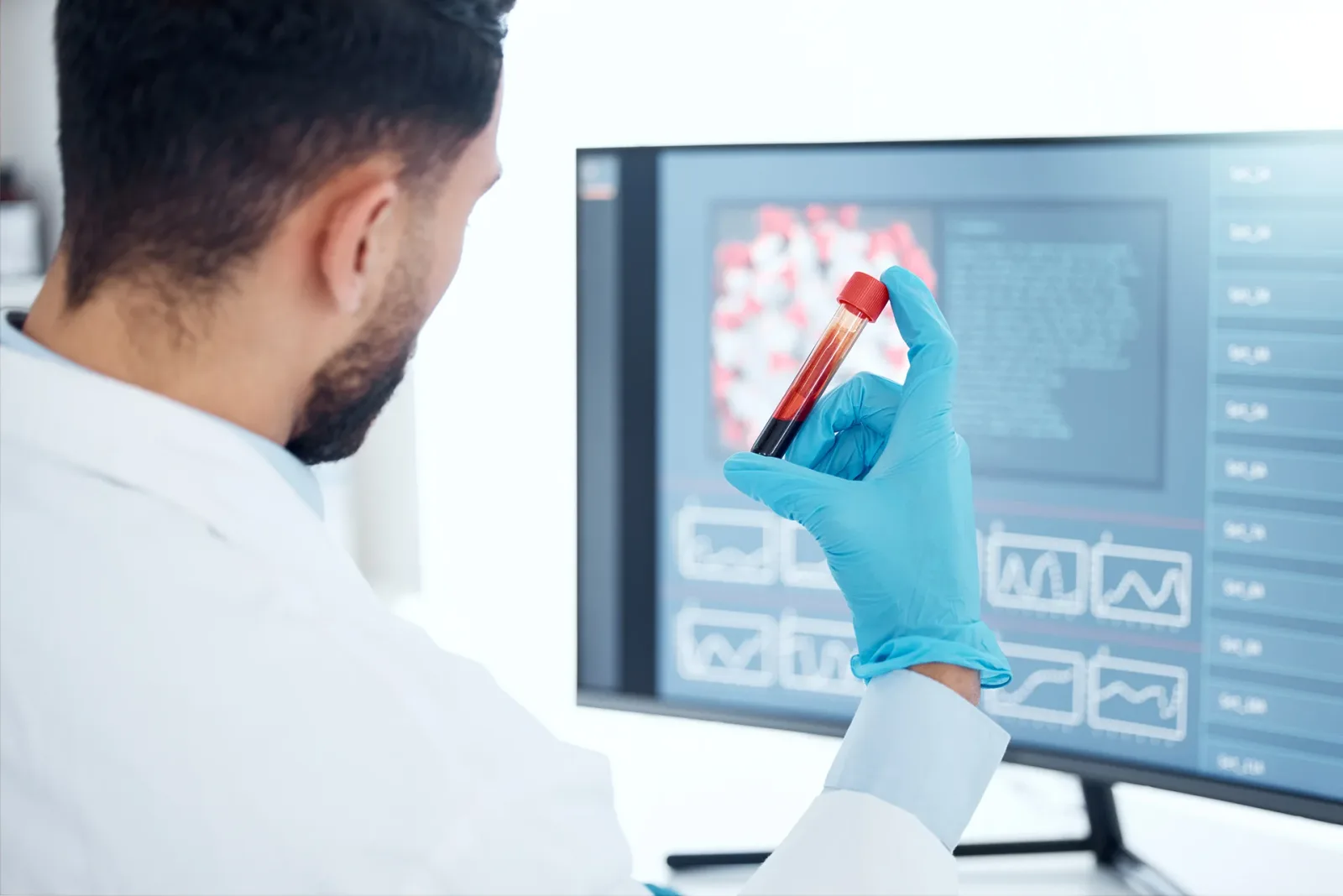 Diamine Oxidase Blood Test Pathology in Australia