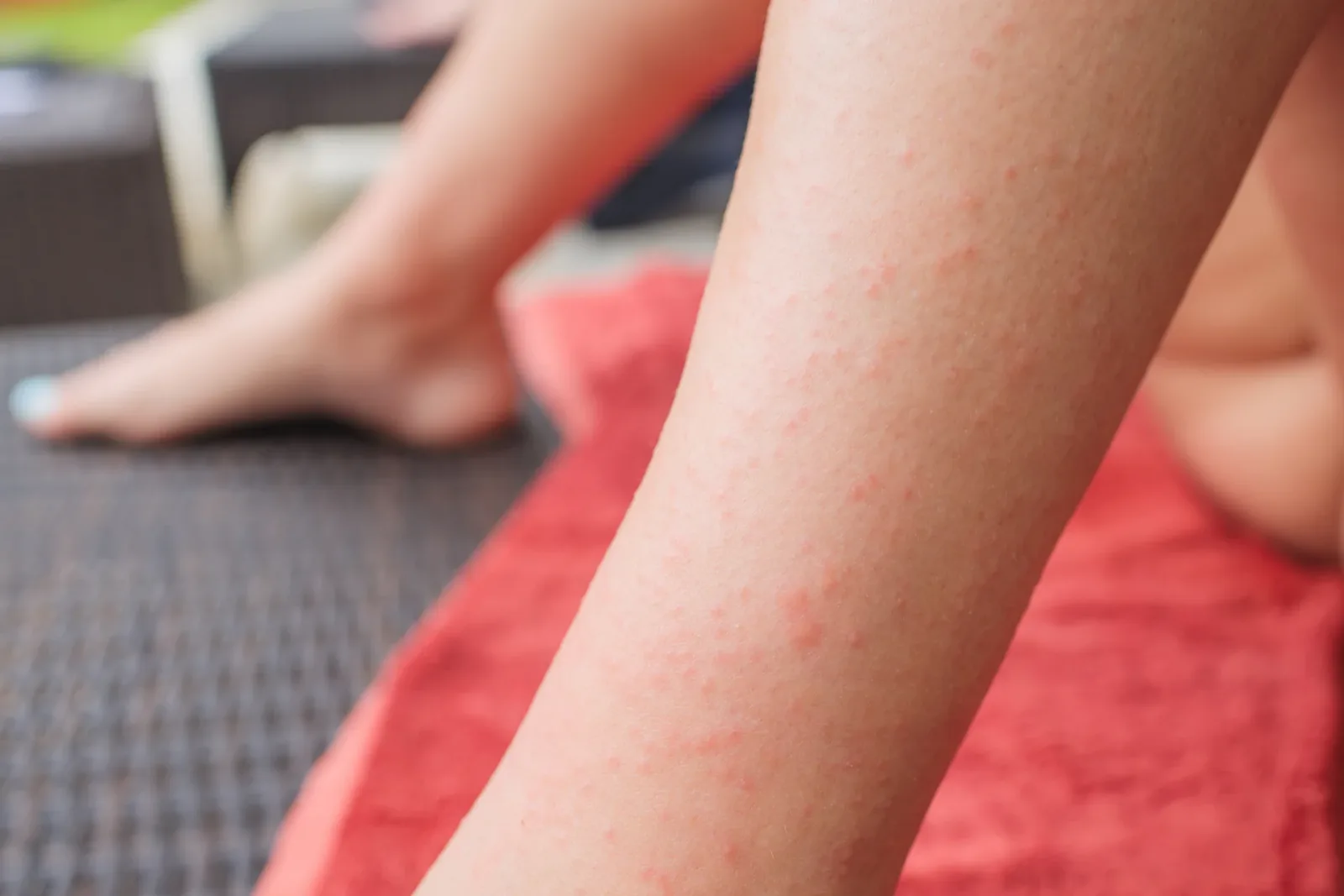Dao Enzyme and Dermatitis Herpetiformis