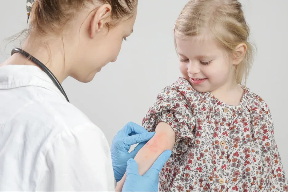 a doctor checks the child's skin allergy