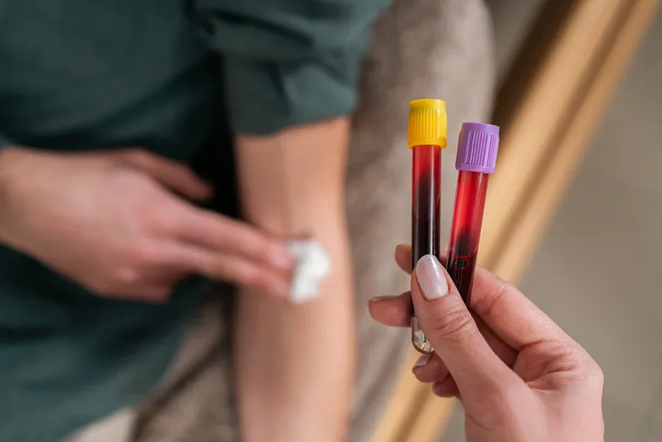 blood test for dao