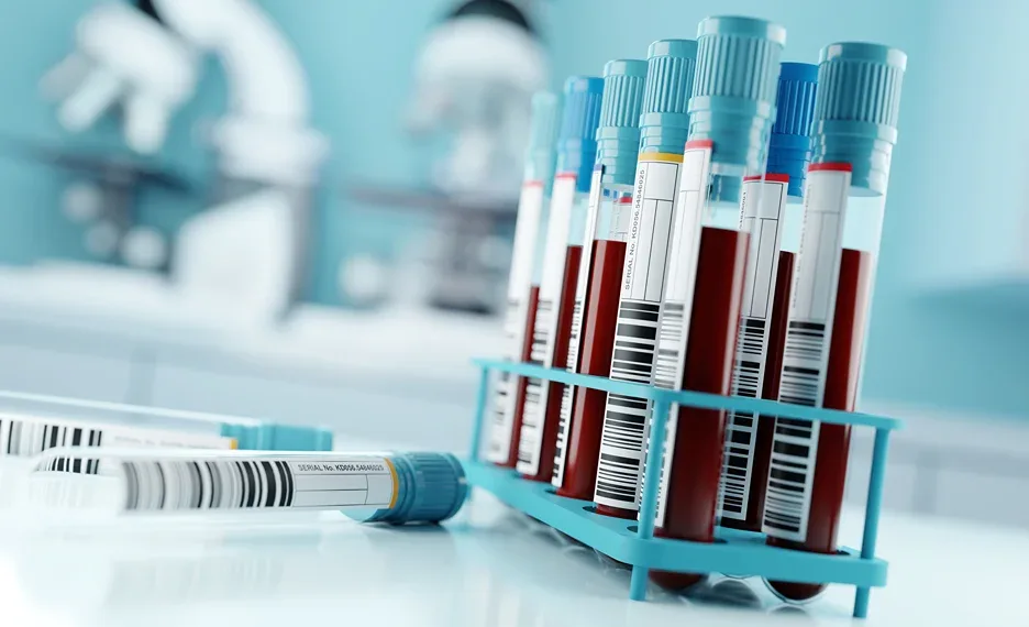 blood test