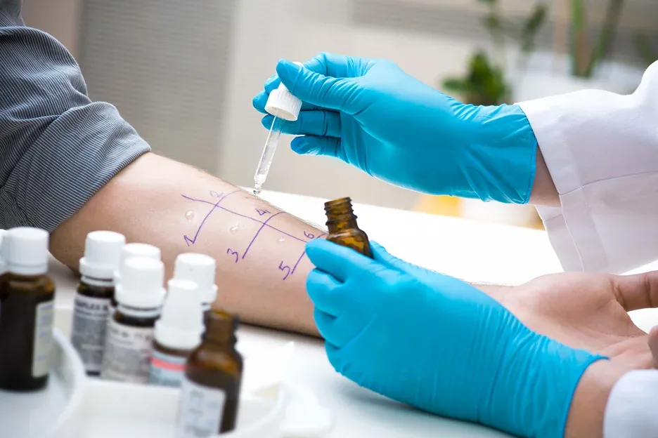 allergy testing