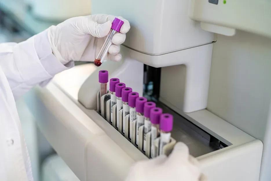 lab testing