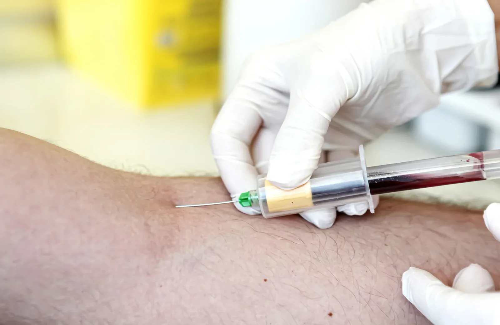 How to Perform Diamine Oxidase Assay: A Comprehensive Guide