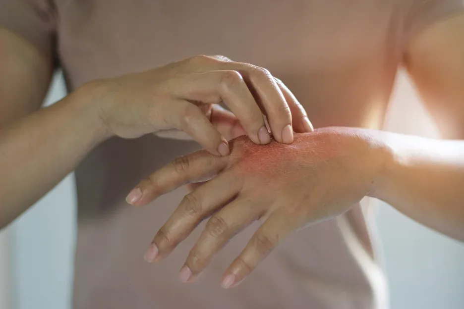 a hand is scratching itch on the skin