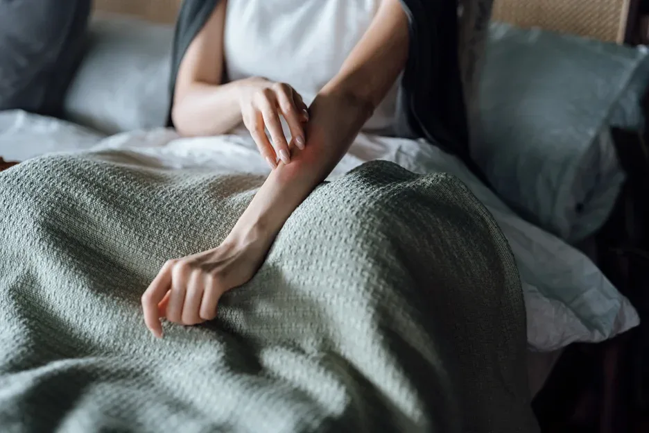a woman scratching skin irration on her arm