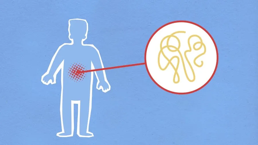 Inflammation/Pain