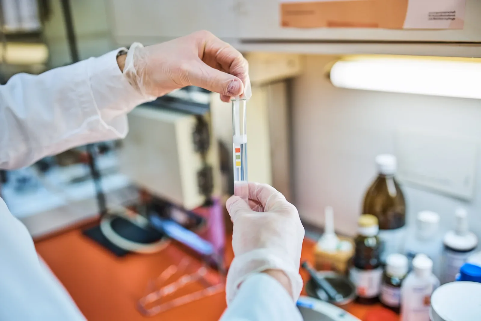 Diamine Oxidase Bioassays: From Theory to Practice