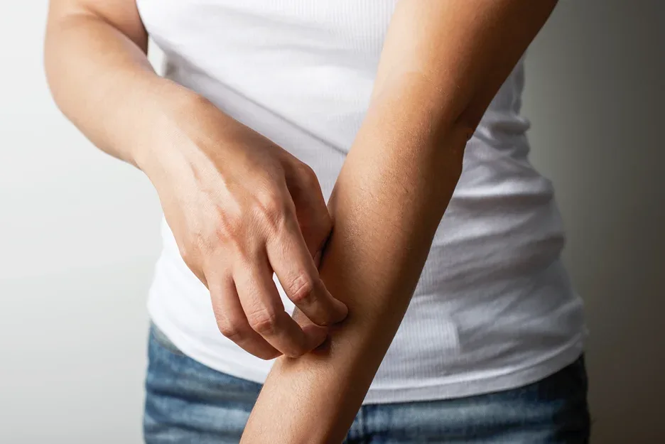 skin allergy