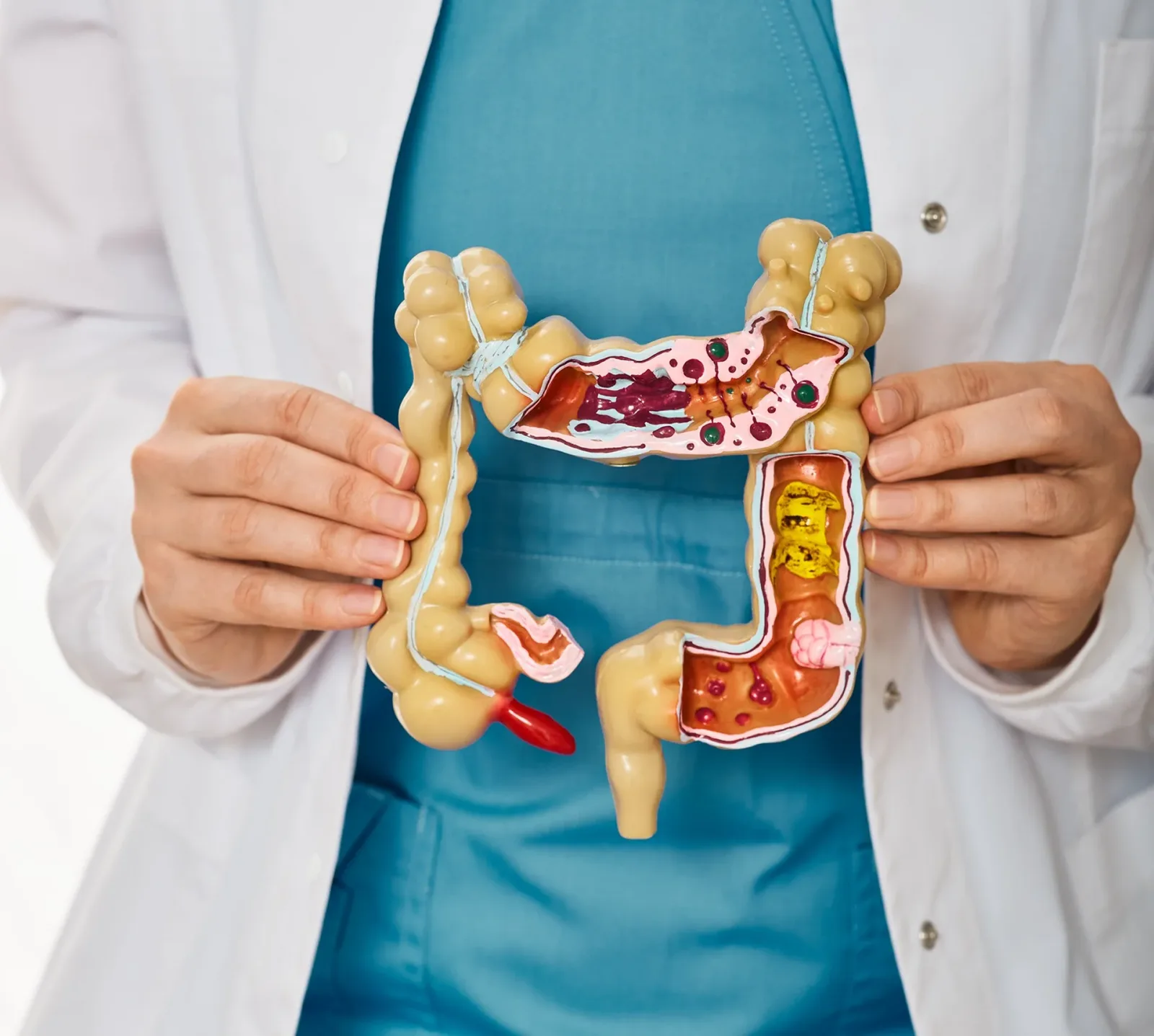 What Are Diamine Oxidase and HNMT in Histamine Intolerance?