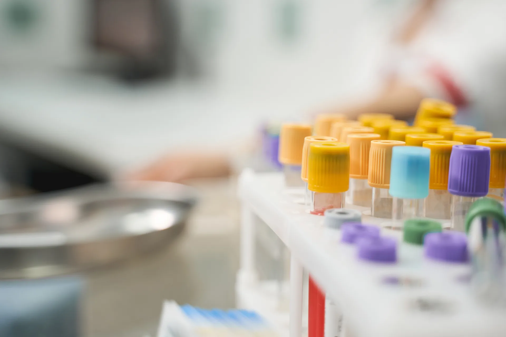 Rack of color-capped blood collection tubes in a laboratory