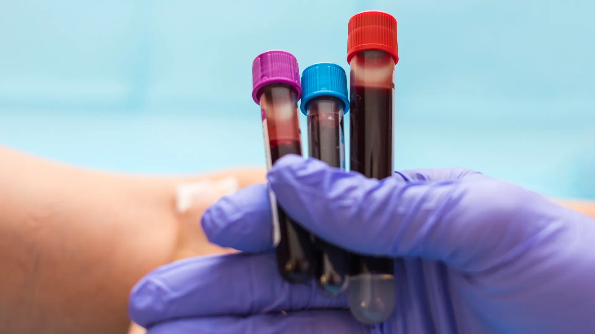 Gloved hand holding three blood collection tubes with colored caps