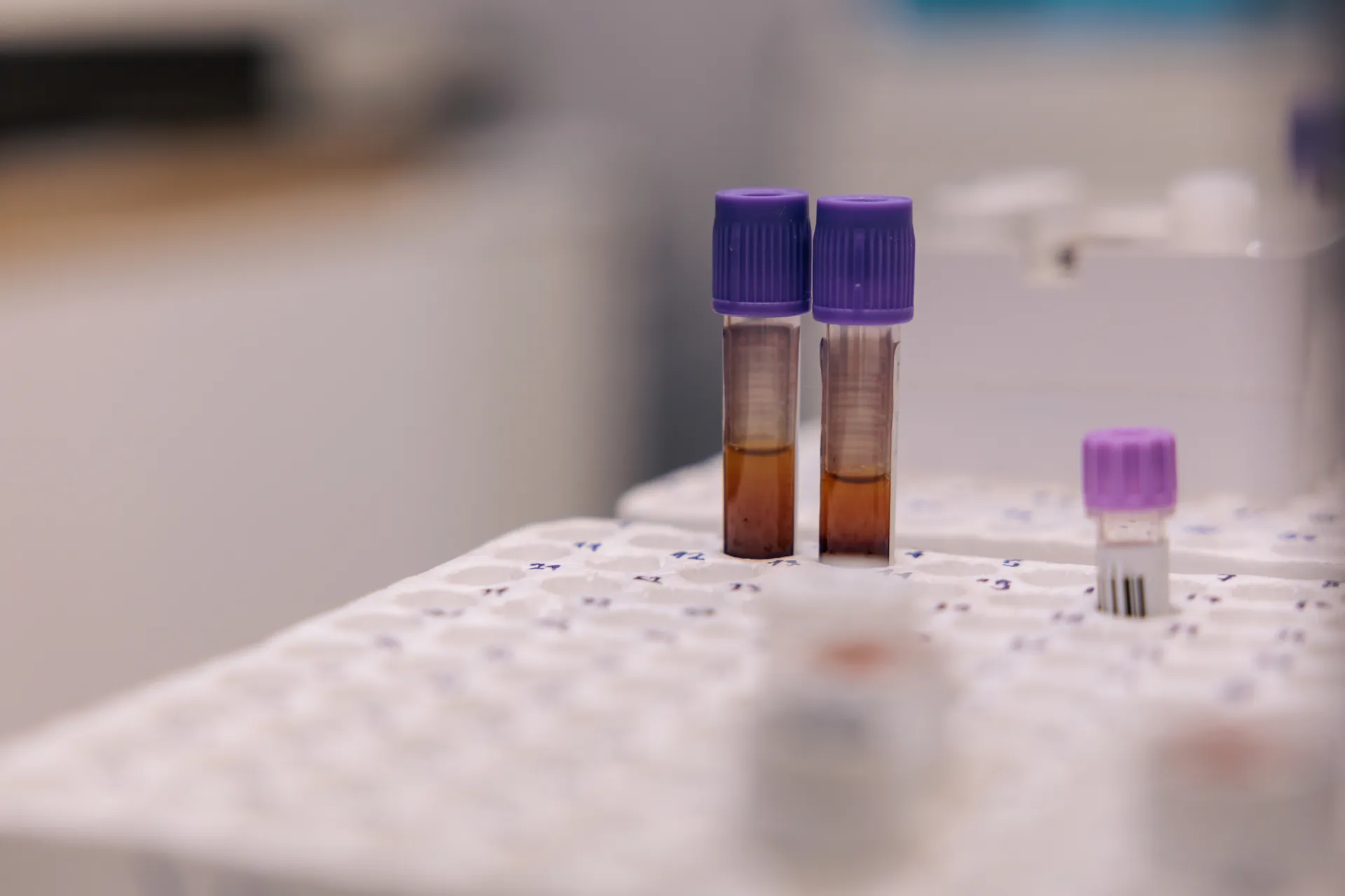 Two sample tubes with purple caps standing in a lab rack