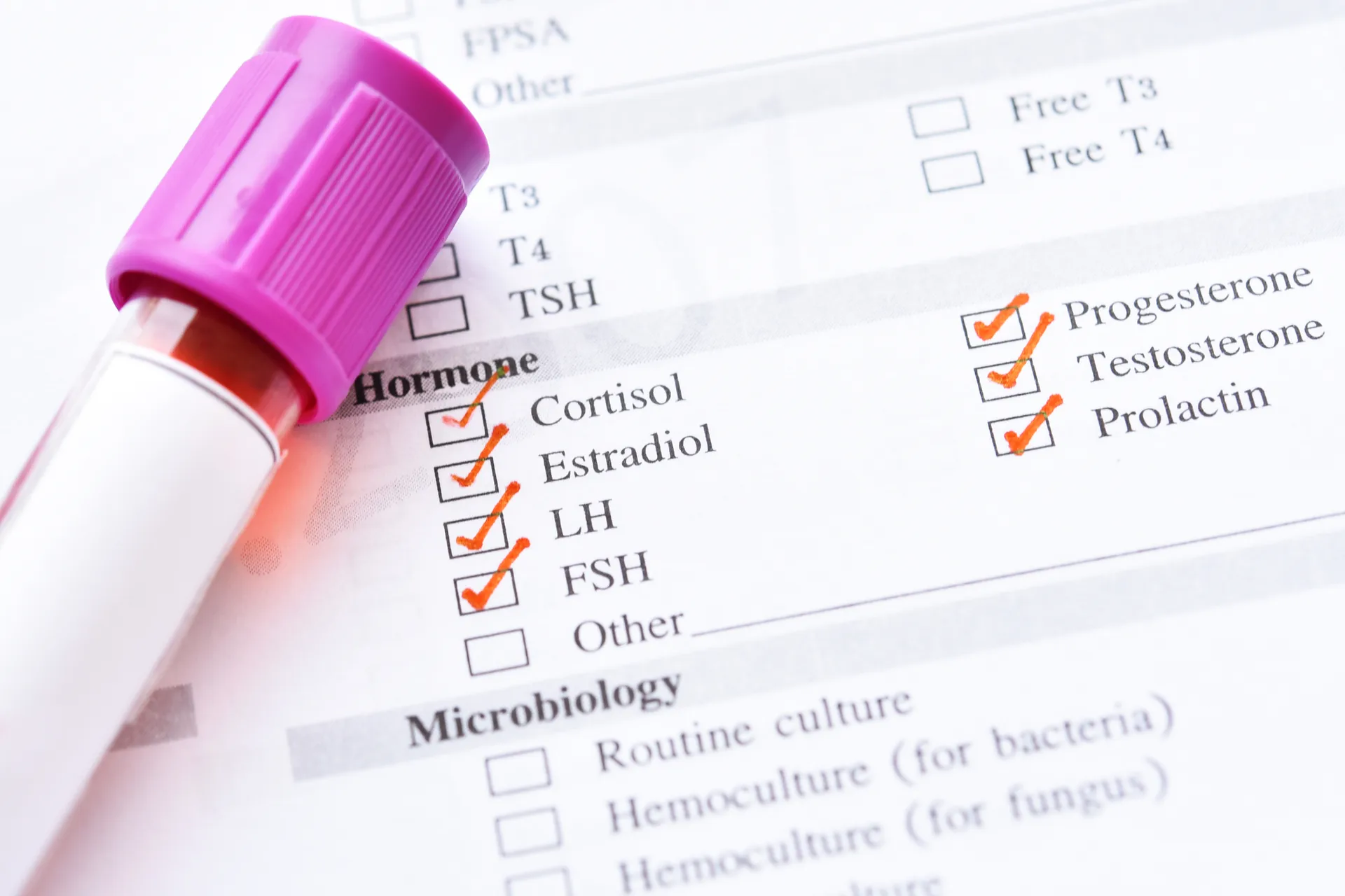 Blood sample tube resting on a lab request form with hormone tests checked