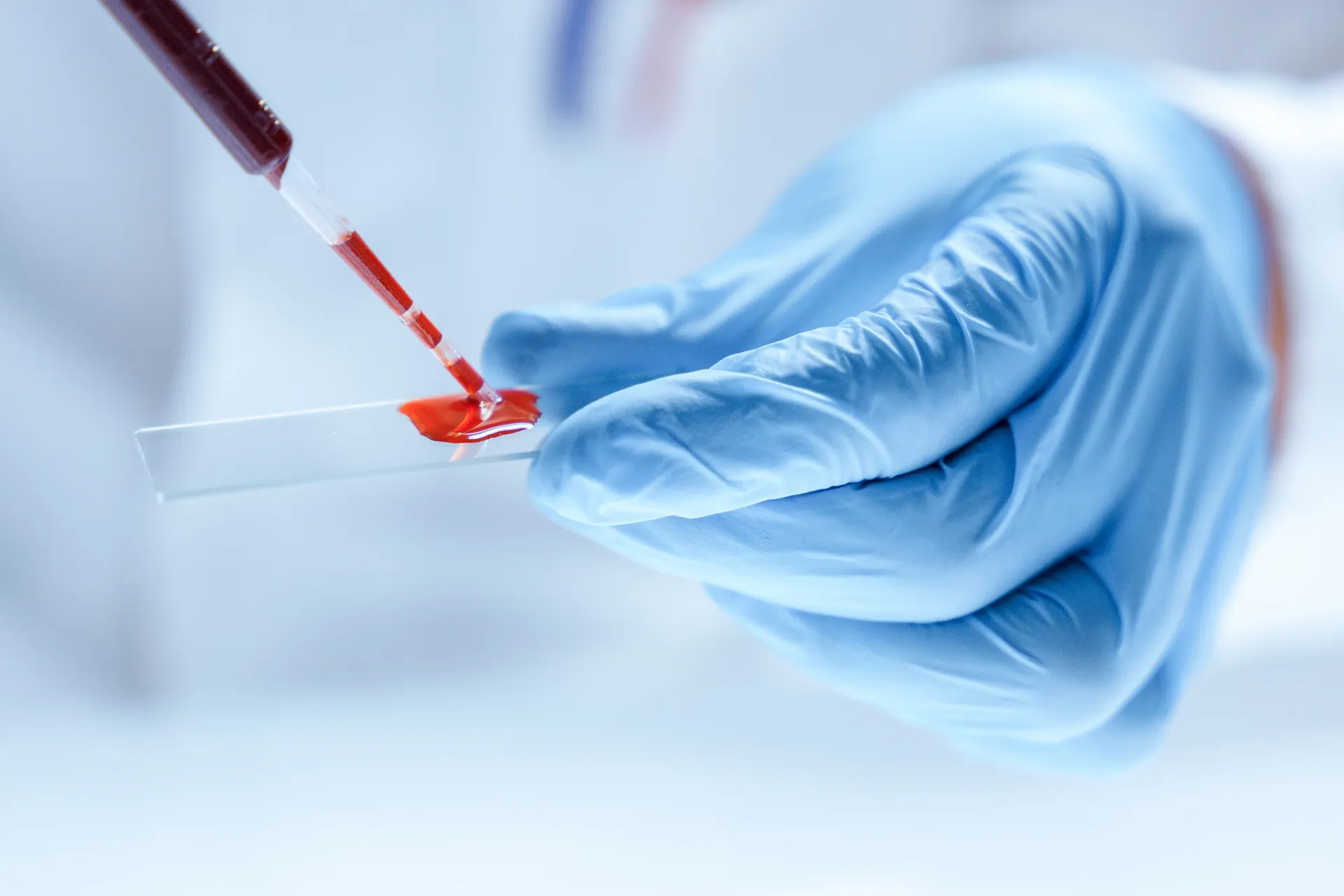 Gloved hand holding a glass slide as a pipette drops blood onto it