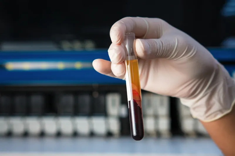 Gloved hand holds a blood sample tube with separated layers in front of lab equipment