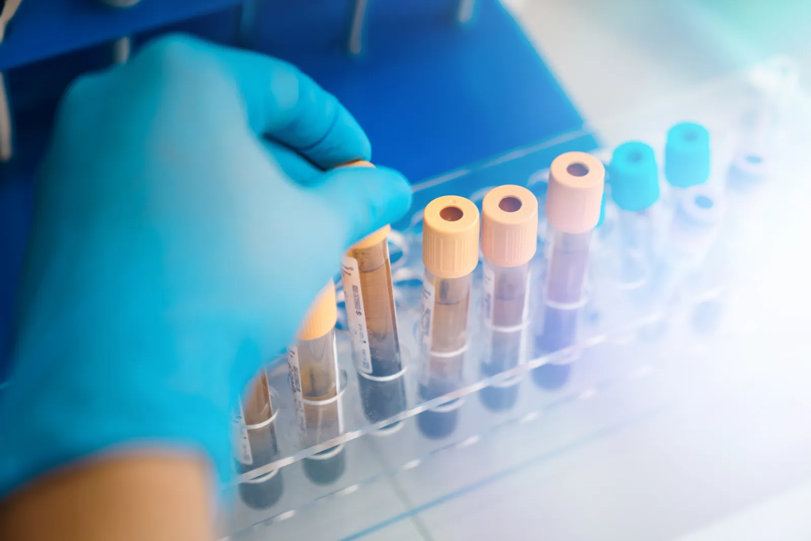 Gloved hand selecting a blood sample tube from a rack in a laboratory