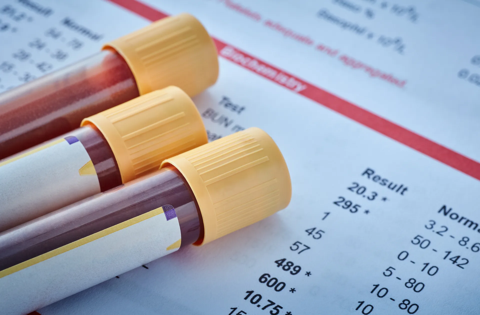Three blood sample tubes lying on a printed lab results report