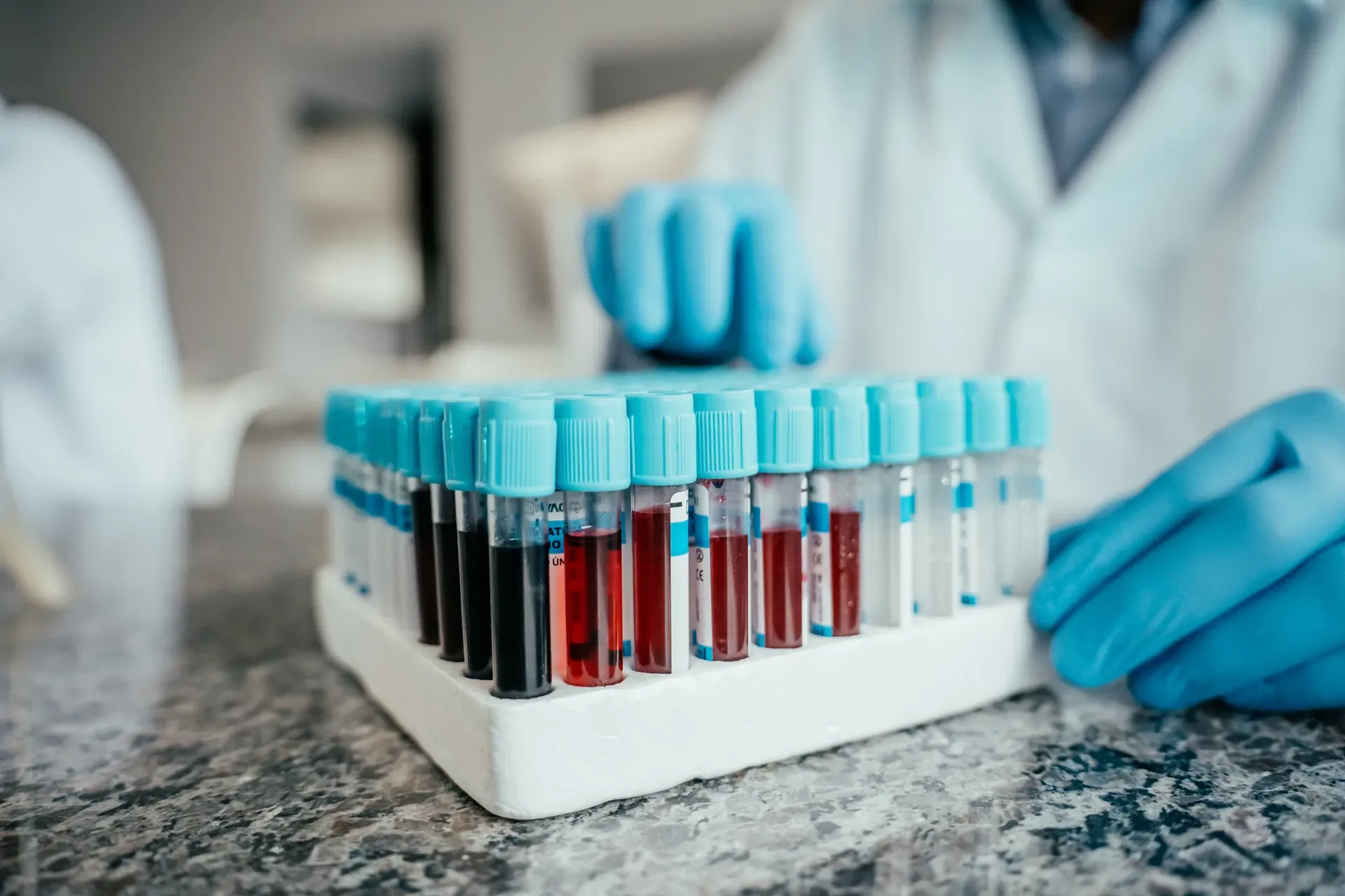 Gloved hands handling a rack of blood sample tubes on a lab counter