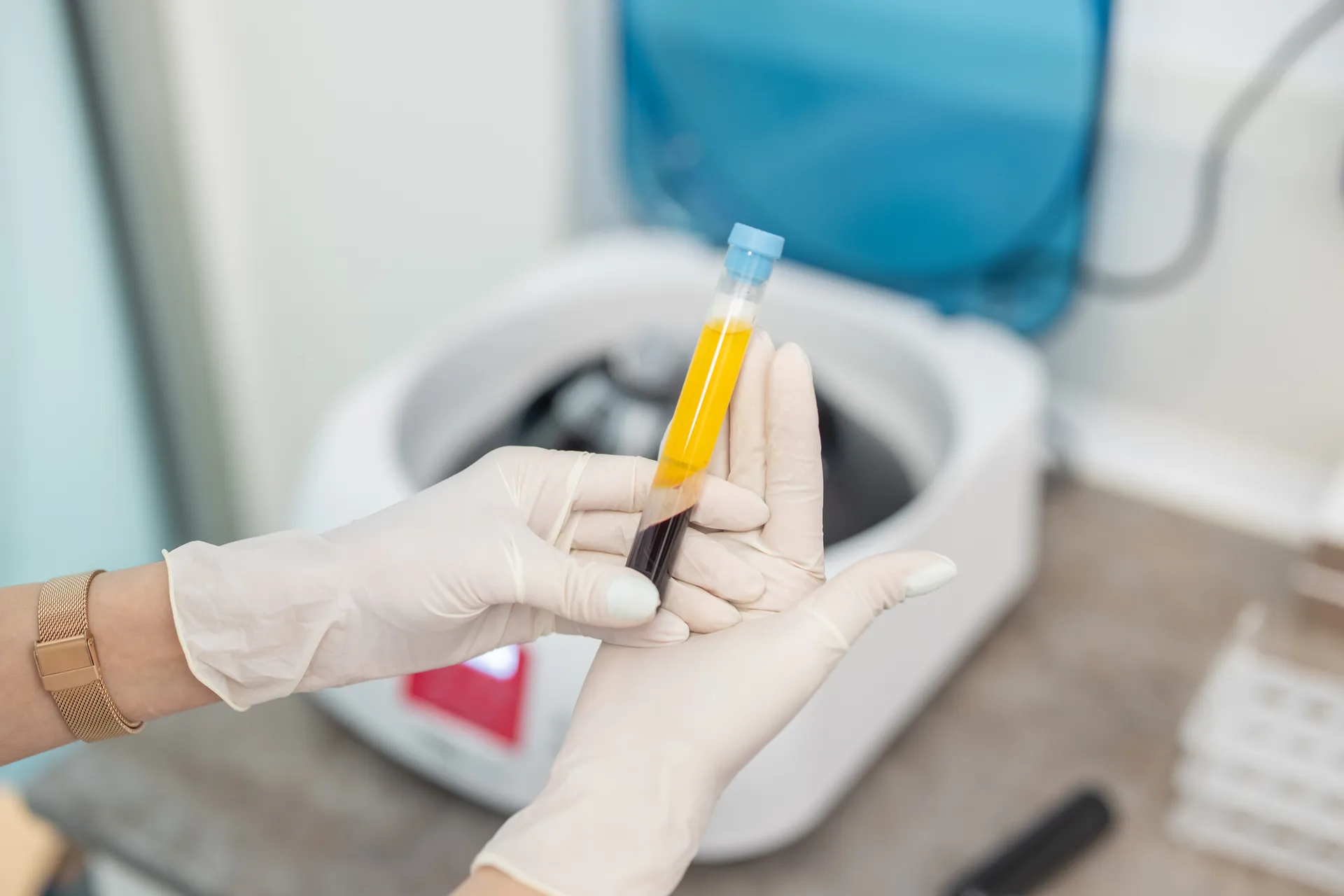 Regenerative therapy preparation