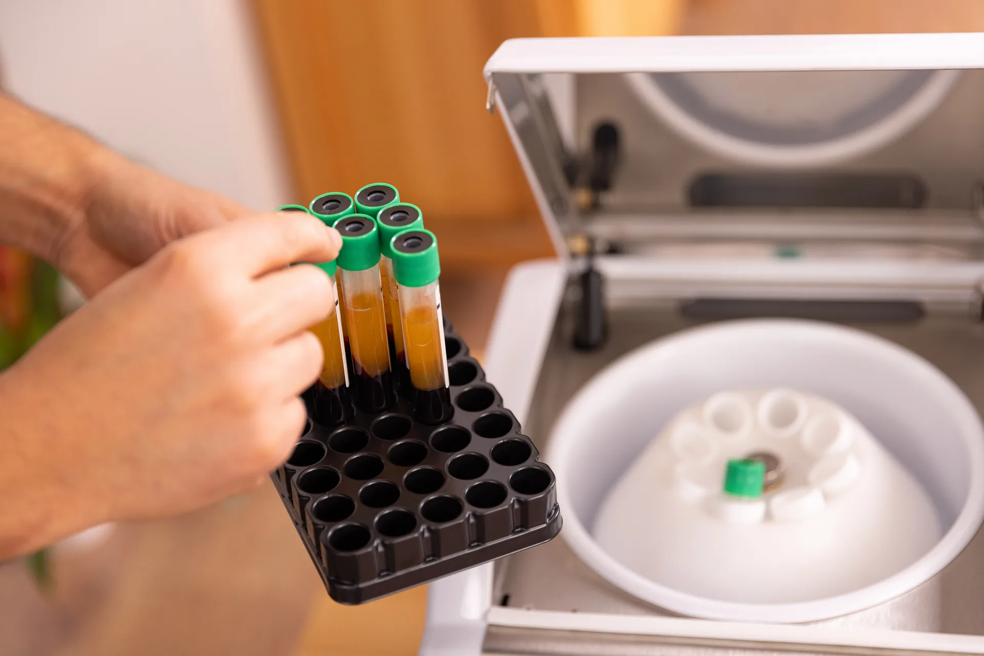 Hand placing a rack of separated blood sample tubes next to an open centrifuge