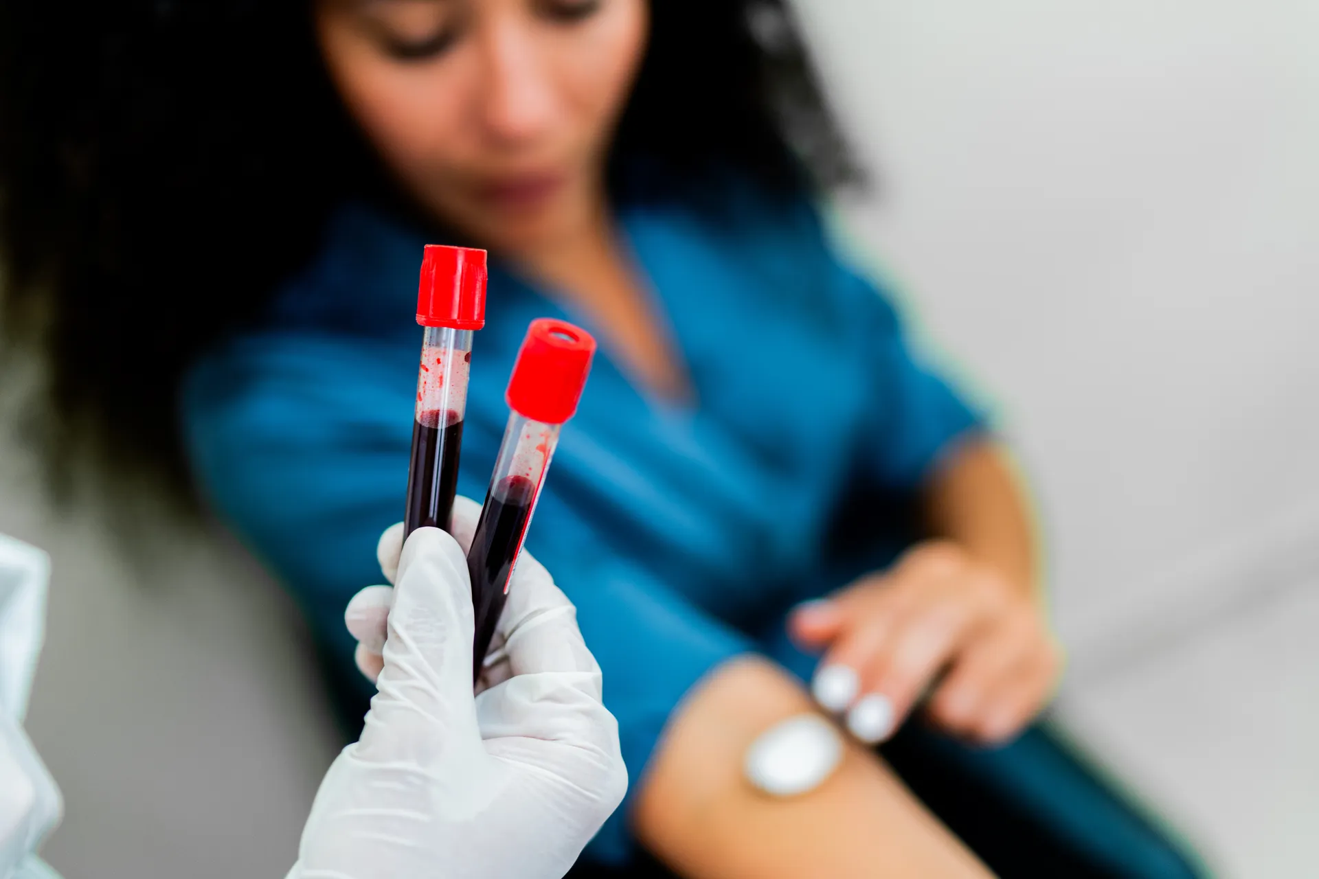 Gloved hand holding two blood sample tubes in front of a patient with a bandage on her arm