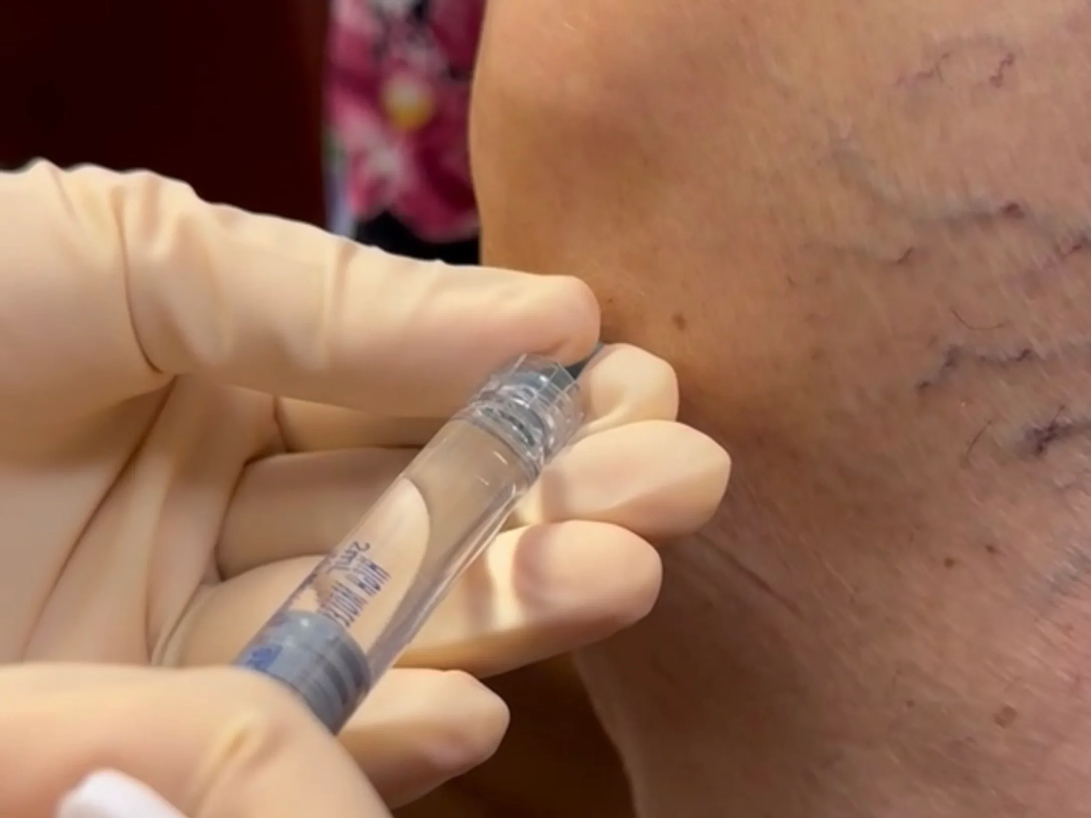 Regenerative medicine — benchtop centrifuge and plasma preparation