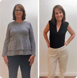 Before and after weight loss result — patient 1