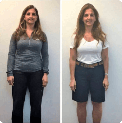 Before and after weight loss result — patient 3