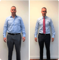 Before and after weight loss result — patient 5