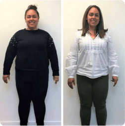 Before and after weight loss result — patient 6